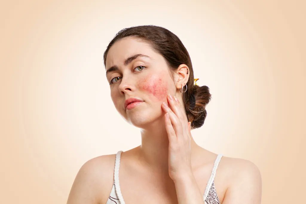 NEastDerm's tweet photo. Are you having trouble combating your rosacea? The highly qualified staff at Northeast Dermatology Associates can help! Contact our office today to book your appointment. We look forward to helping you on your skin improvement journey! 
#dermatologist #skinhealth #skingoals https://t.co/GO89HNttWO