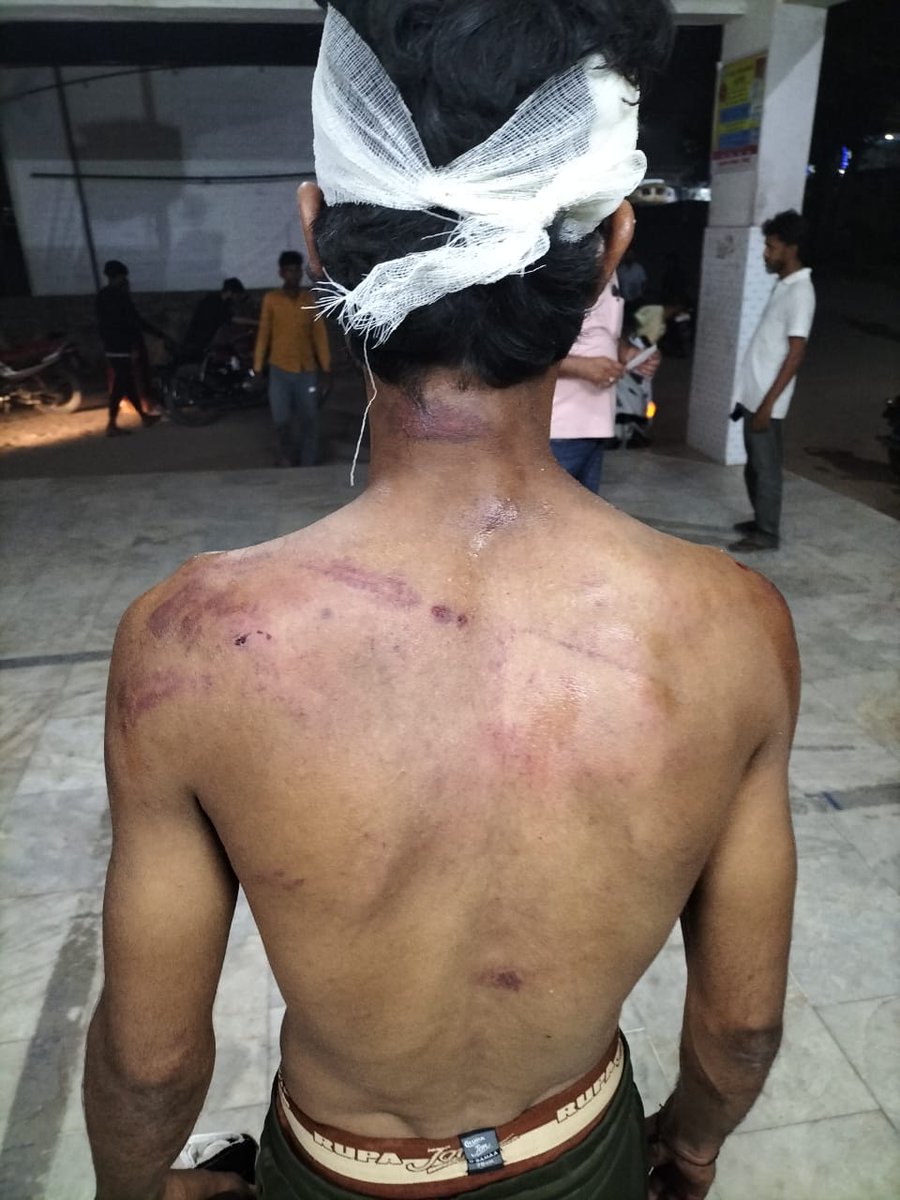 SyedIbnSyed1's tweet photo. @CMNitishKumar @gaya_dm @gaya_police 

टोटो चालक (शमीम) को रिज़र्व के बहाने पलकिया में बुला कर असामजिक तत्वों ने रात के अंधेरे में बेइंतेहा मारा, और बोला के म��ल्लो को मारो!

क्या ऐसे लोगो को शिकंजे में लेने की जरूरत नहीं है जिन्होंने समाज को बर्बाद कर रखा है? https://t.co/2t47FeMwK2
