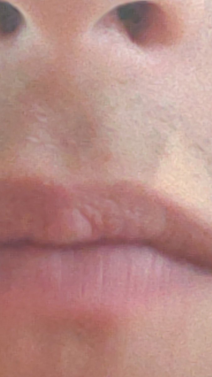 neapian's tweet photo. Mouth mouth mouth mouth mouth https://t.co/P592eGignr