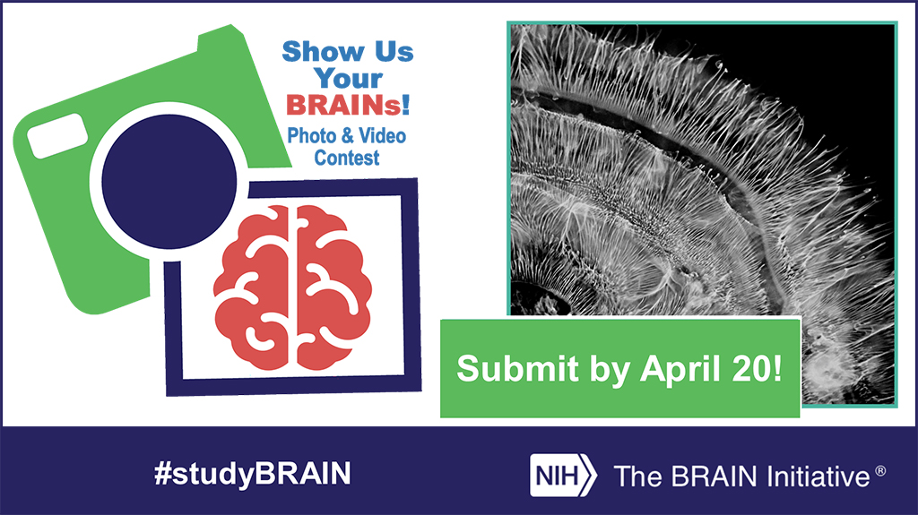 ONE WEEK LEFT to submit your gorgeous images to <a href="/NIH/">NIH</a>'s The #BRAIN Initiative Show Us Your BRAINs! Photo &amp; Video Contest! Deadline: April 20 #studyBRAIN