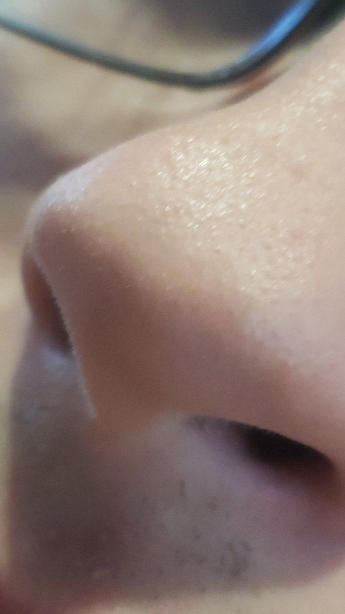 neapian's tweet photo. Nose nose nose noes noes nose https://t.co/hu0R2ru9Hm