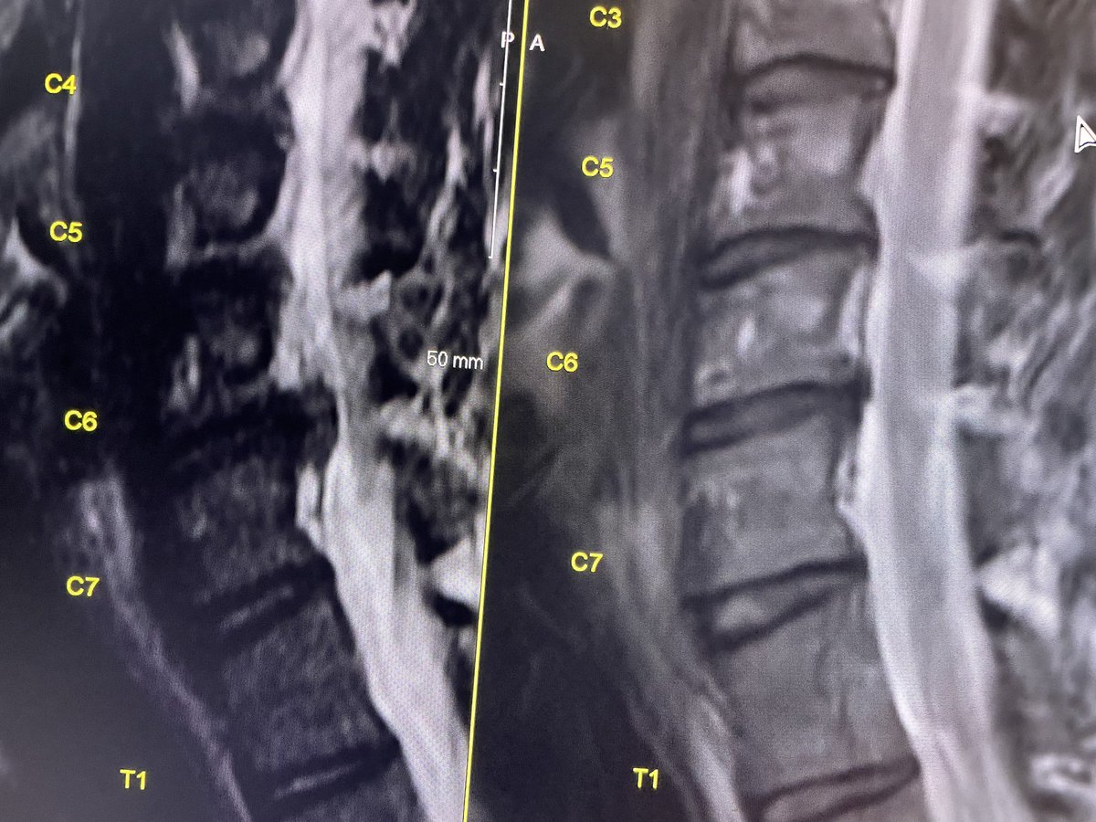 Zachary Stewart tweet media