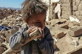 ikic_sbu's tweet photo. خودشان را داعیه دار حقوق بشر و مخالف جنگ می‌دانند اما نسبت به بیش از ۶۰ سال جنایت و خونریزی صهیونیست ها در #فلسطين اشغالی 
و ۷ سال جنگ و بمباران در #يمن توسط آل سعود، واکنشی نشان نمی‌دهند و استوری "برای یمن" و "برای فلسطین" نمی‌زنند. https://t.co/bY0mJO0ANS