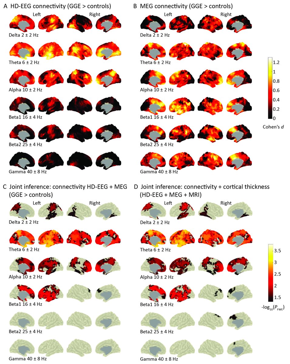 EpilepsiaJourn's tweet photo. Combined electrophysiological and morphological phenotypes in patients with genetic generalized epilepsy and their healthy siblings https://t.co/O2r9DR60K8
#epilepsy #epilepsyresearch #corticalthickness #interictal #endophenotypes @IlaeWeb @WileyNeuro @yesILAE https://t.co/P5F0KbpR0r