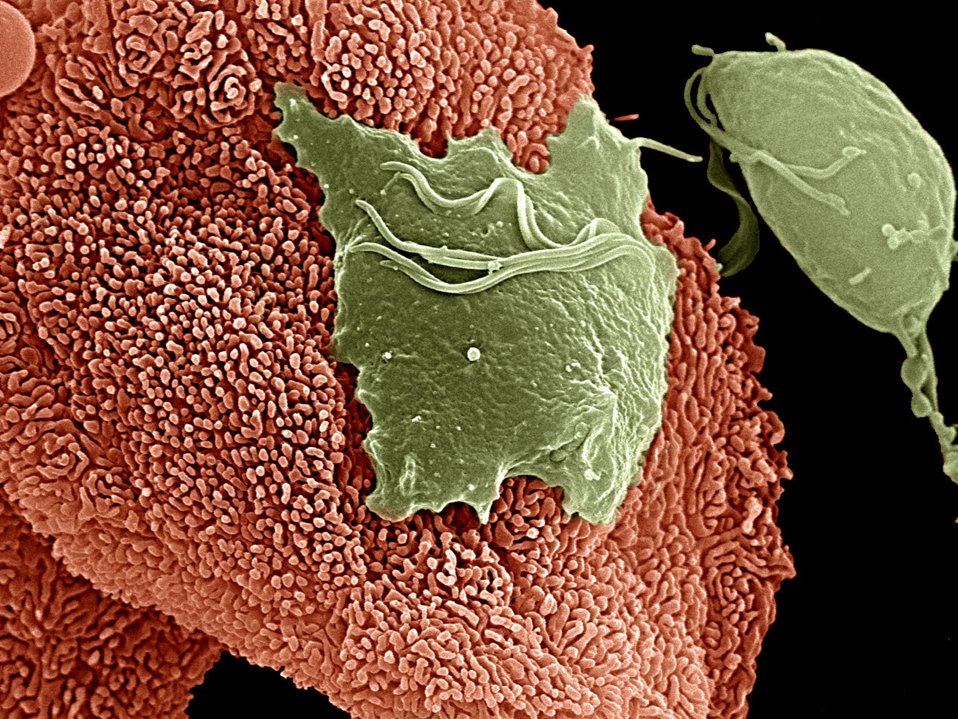 Happy #WorldMicroscopeDay 
Scanning electron microscopy of the parasite Trichomonas vaginalis (green) adhering to a vaginal epithelial cell (red)