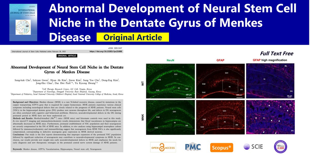 IntJStemCells's tweet photo. Abnormal Development of #Neural_Stem_Cell Niche in the Dentate Gyrus of #Menkes_Disease
open access🌷https://t.co/WmSzbHyW45
International Journal of Stem Cells
Published online February 28, 2022; Dae Hwi Park
#ATP7A #Vascularization #Hippocampus #Neurogenesis https://t.co/pbwvKgbR7J