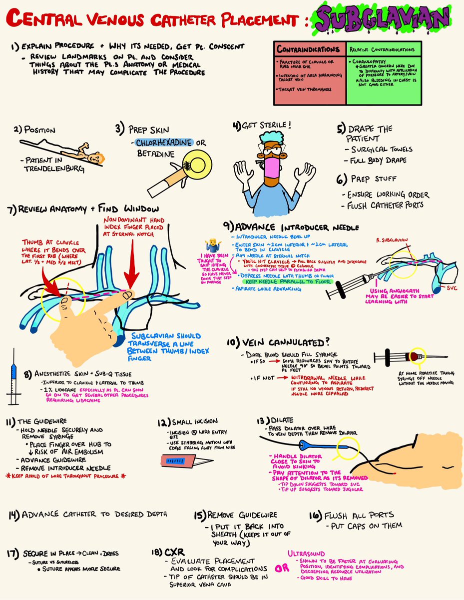 CritCultivation's tweet photo. Subclavian Lines using landmarks. I will be presenting this on my unit Friday. Thanks for all the pro tips they have been super helpful! Keep them coming! #ICU #MedTwitter #FOAMcc https://t.co/2woqYonbqS