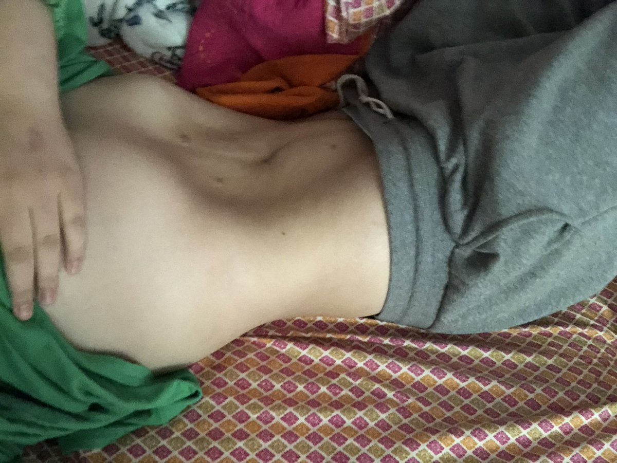 cloudiecals's tweet photo. My weight for my height is supposed to be like 149 but this was me at 170. Obv I coulda been thinner especially in my thighs but I can’t imagine what I’d look like at 140 https://t.co/895aUxBVby