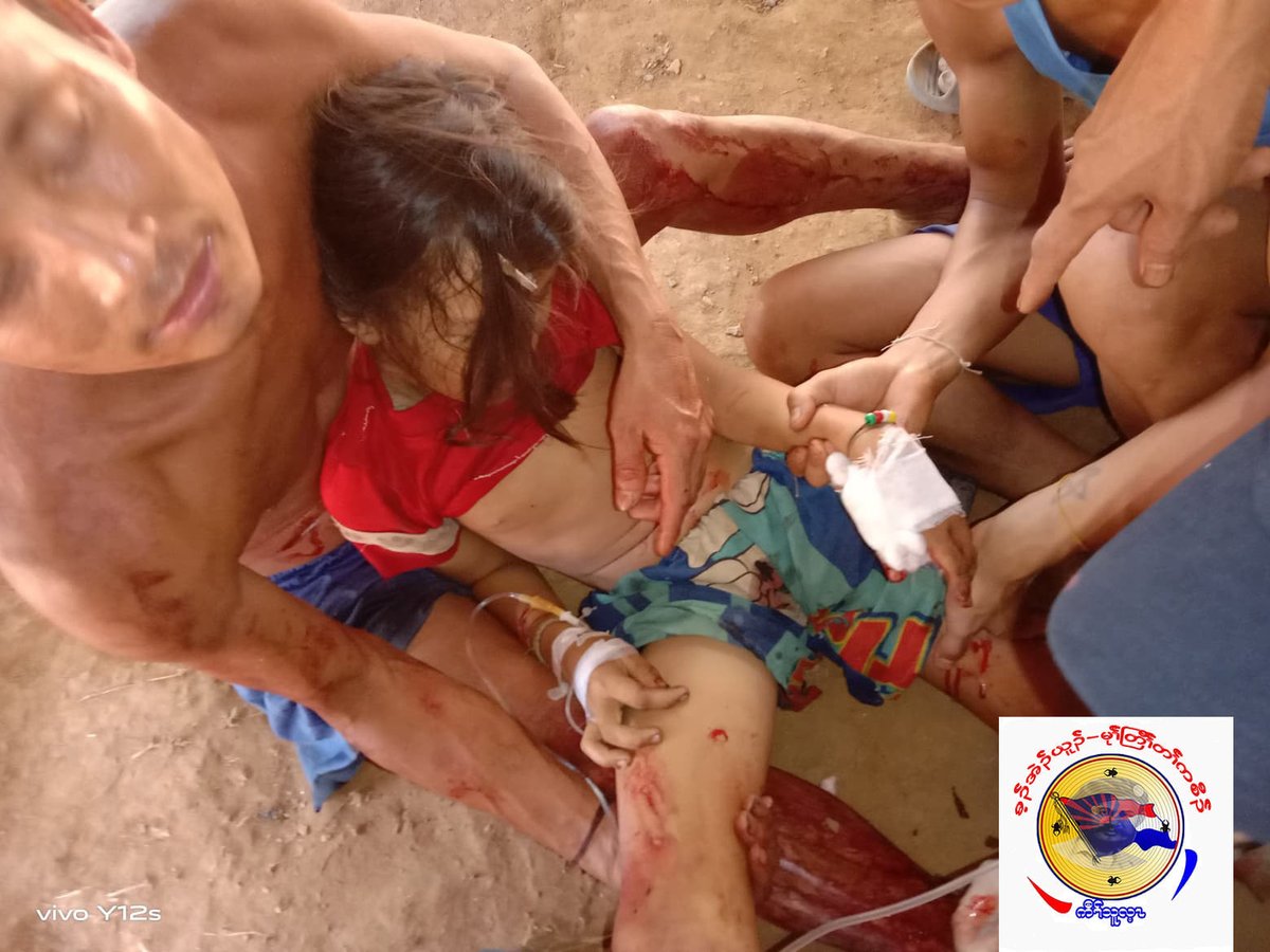 IrrawaddyNews's tweet photo. Four civilians including two children aged 11 and 12 from Karen State’s Papun Township were seriously wounded when junta troops shelled a village Wednesday morning. Six cows were killed and three others were injured in the artillery strikes. (Photo: KNU) #WhatsHappeningInMyanmar https://t.co/twmG4vTWAu