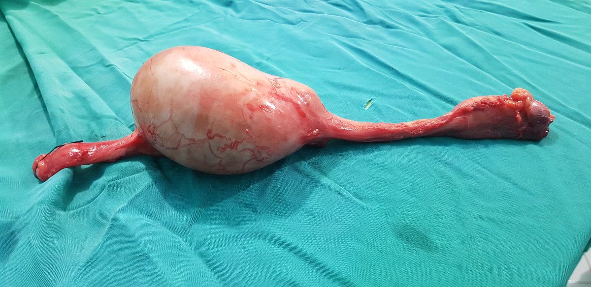 Bismillaah...
Suatu ketika ada bapak2 datang k praktek dgn keluhan buah zakarnya membesar sejak lebi...