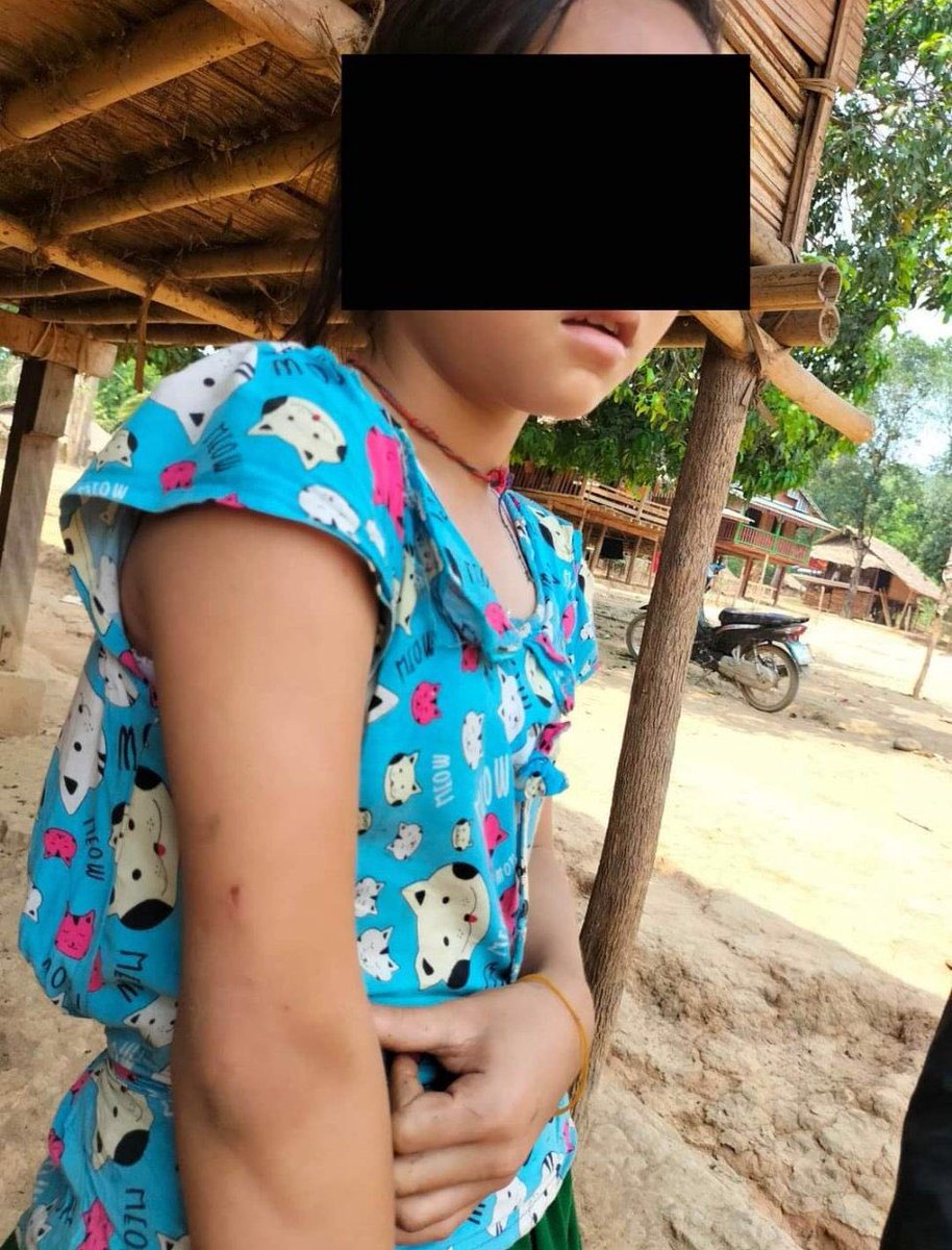 khant_thuu's tweet photo. Tw // Blood
KNU stated that junta’s subordinate forces shelled artilleries in Htoohaylo village, Butho tsp, yesterday, resisting in injuring of 4 residents including 2 children and an elderly
#RevolutionaryThingyan #2022Apr14Coup #WhatsHappeningInMyanmar https://t.co/p2xMt7ErNF