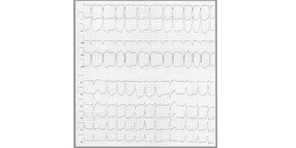 Anya Creaser tweet media