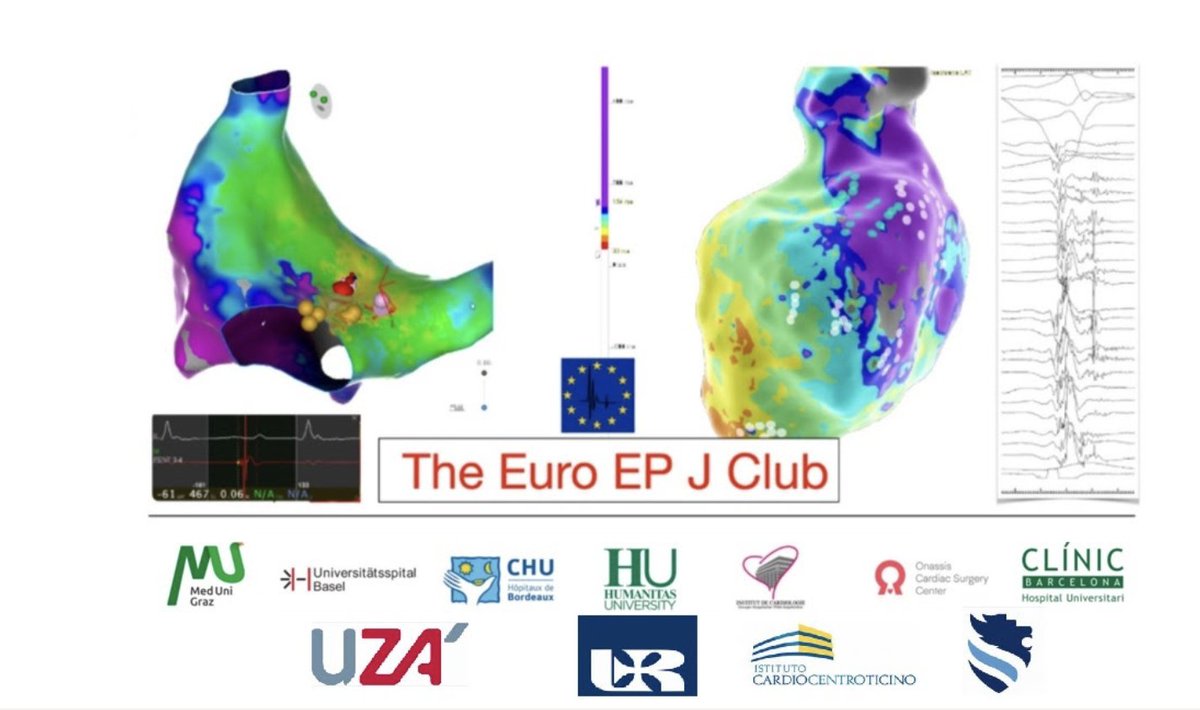 Today at 5.15pm CET in the Euro EP Journal club we will (try to !) talk about the latest paper from Prof. Haissaguerre on the substrate of VF ! 

Join us for an amazing discussion ☺️

us02web.zoom.us/meeting/regist…
