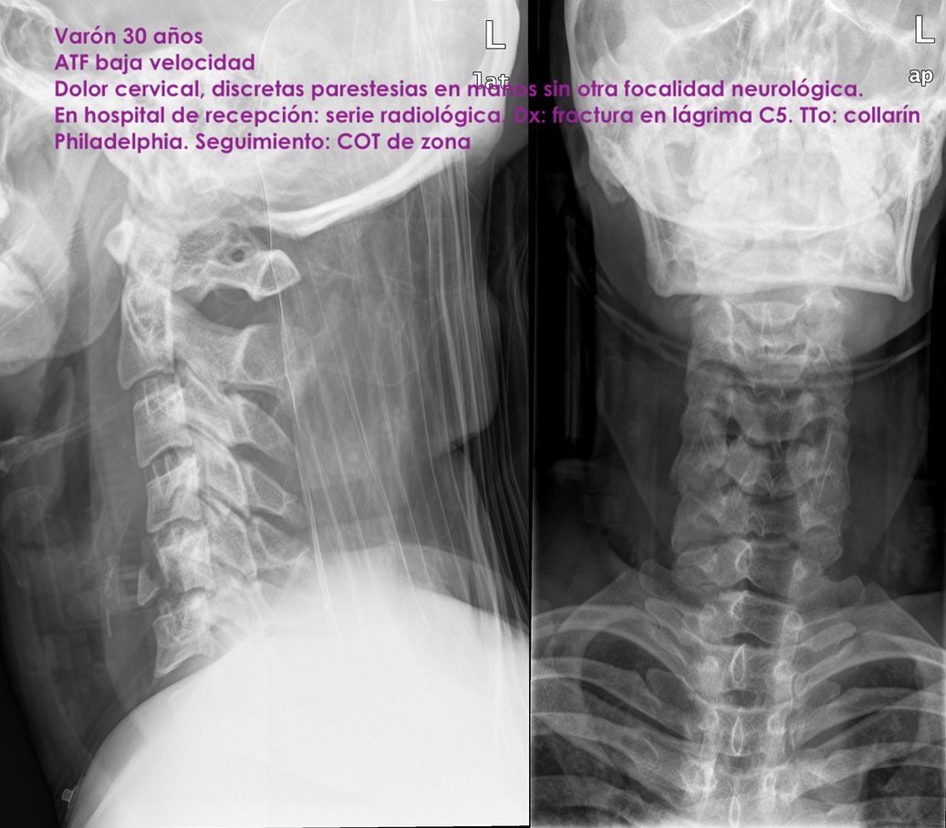 Womcot Spain tweet media