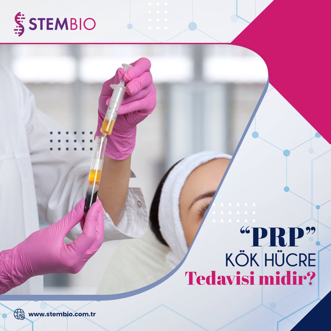 StembioCtech's tweet photo. Son yıllarda sıkça adını duyduğumuz PRP (Platelet Rich Plasma), yani trombosit hücreleri bakımından zengin sıvı, tıbbın pek çok alanında kullanılmaktadır.🩸
Ancak herkesin aklında aynı soru var; ‘’PRP’’ kök hücre tedavisi midir❓
#stembio #stemcord #prp #prptedavisi #kökhücre https://t.co/4hh29hRZVK