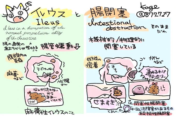 【イレウスと腸閉塞のちがいめも】
ちょっと前(?)までは日本ではだいたい同じみたいに言われてましたが違います🐱

・イレウス:腸管蠕動の機能低下。麻痺性イレウス
・腸閉塞:腸管が機械的・物理的に閉塞している。
腫瘍により閉塞する閉塞性腸閉塞、
血流障害を伴う絞扼性腸閉塞

 #かげ看 