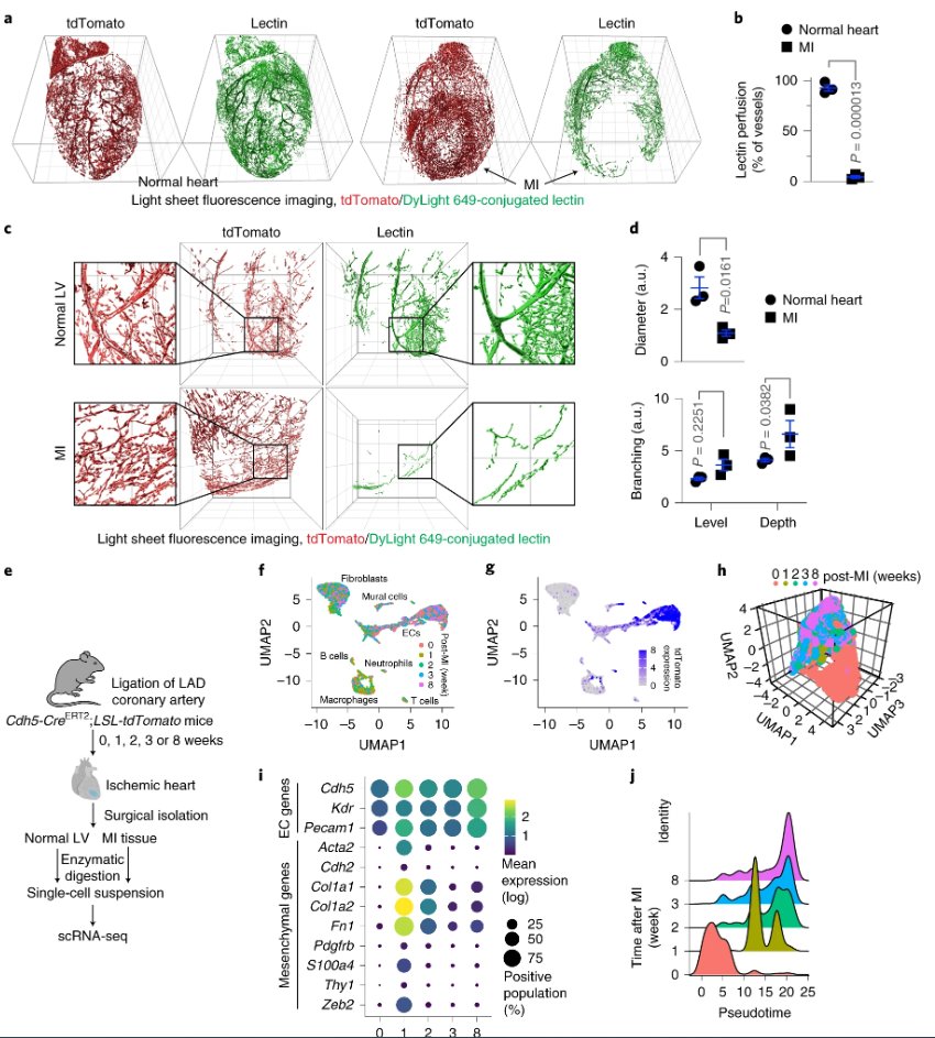 NatureCVR's tweet photo. Research|@AnnaYanqing and Yi Fan’s teams @Penn @PennMedicine show that targeting the PDGF-Snail axis in #endothelial cells normalizes  aberrant vascularization and improves cardiac function recovery post-#MyocardialInfarction 

👉https://t.co/JEOtdcdPJF https://t.co/tKbK3uvSZI