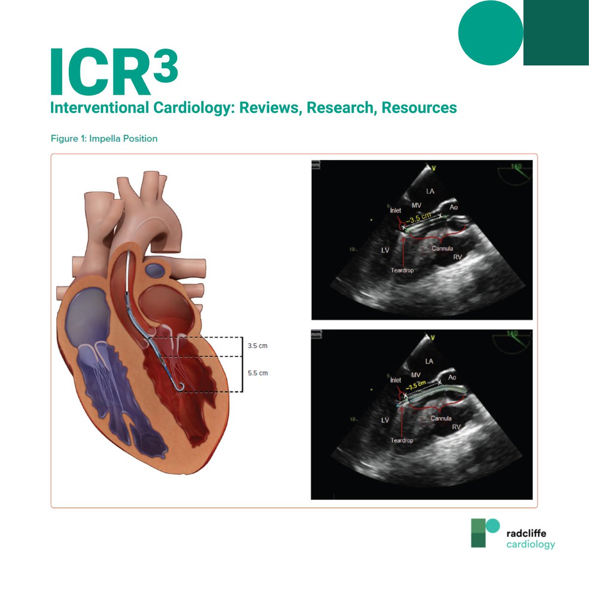 Radcliffe Cardiology tweet media