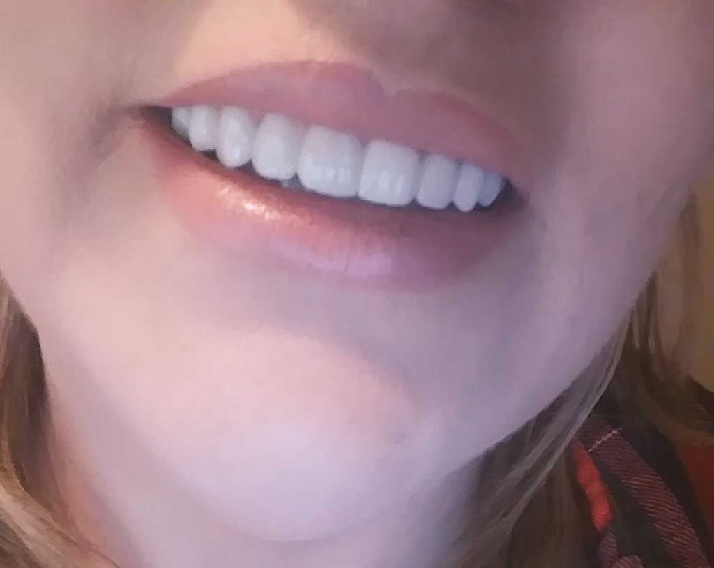 AmandaRoseArose's tweet photo. #thursdayvibes #positivity #manifestation #KeepGoing #nomatterwhat 🌹💪💕💋
#ThankfulThursday to #drbee @FirstClassDenta for this #Miracle #smile 😃😀😘 https://t.co/T4IYISinIR