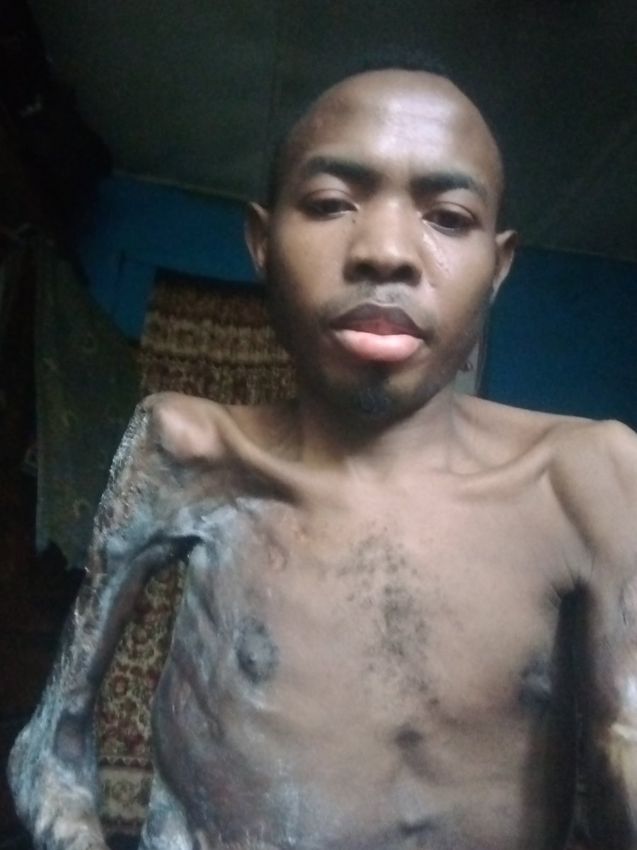 KaluKaris's tweet photo. Goodafternoon every1 dat cums across dese message pls I really need help frm good hearted nigeria &amp;beyond pls I need hlp am a sickle cell patient&amp;am in crisis right nw bt I dn't ve anymedication plshelp me with anything u cn pls am in pains.
0029417514
Sterling bank
Kalu chinedu https://t.co/MK4OhsyP2c