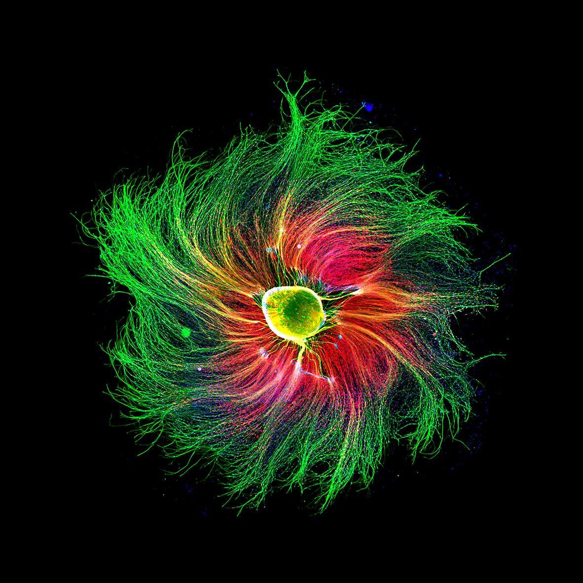Sensory neuron is shown using fluorescence technique:

#neuroscience by P. Diaz