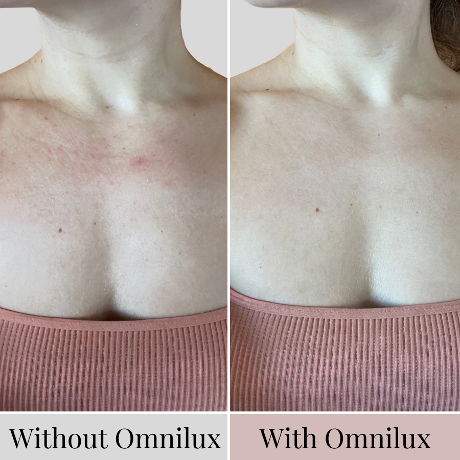 The aging process doesn't end at your face, so why should your skincare? Utilize state-of-the-art skincare technology in Contour NECK &amp; DÉCOLLETÉ to lift, calm irritation, and reduce uneven tone and texture on the neck and chest.
SWIPE 👉 to see just how good the results are.