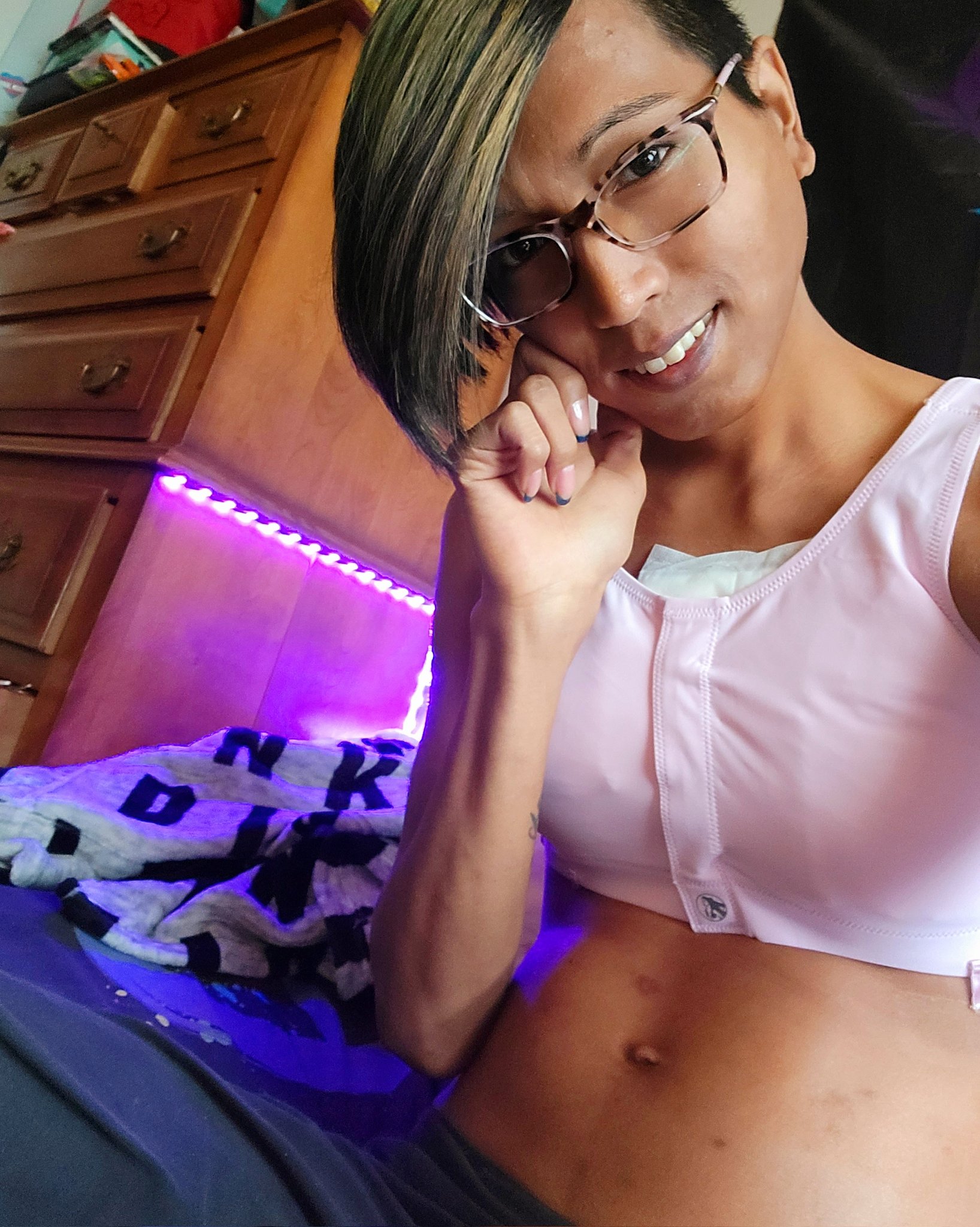 Bout 40% healed ??
Can't wait to free my boobies ? https://t.co/NHh5lPJEKN