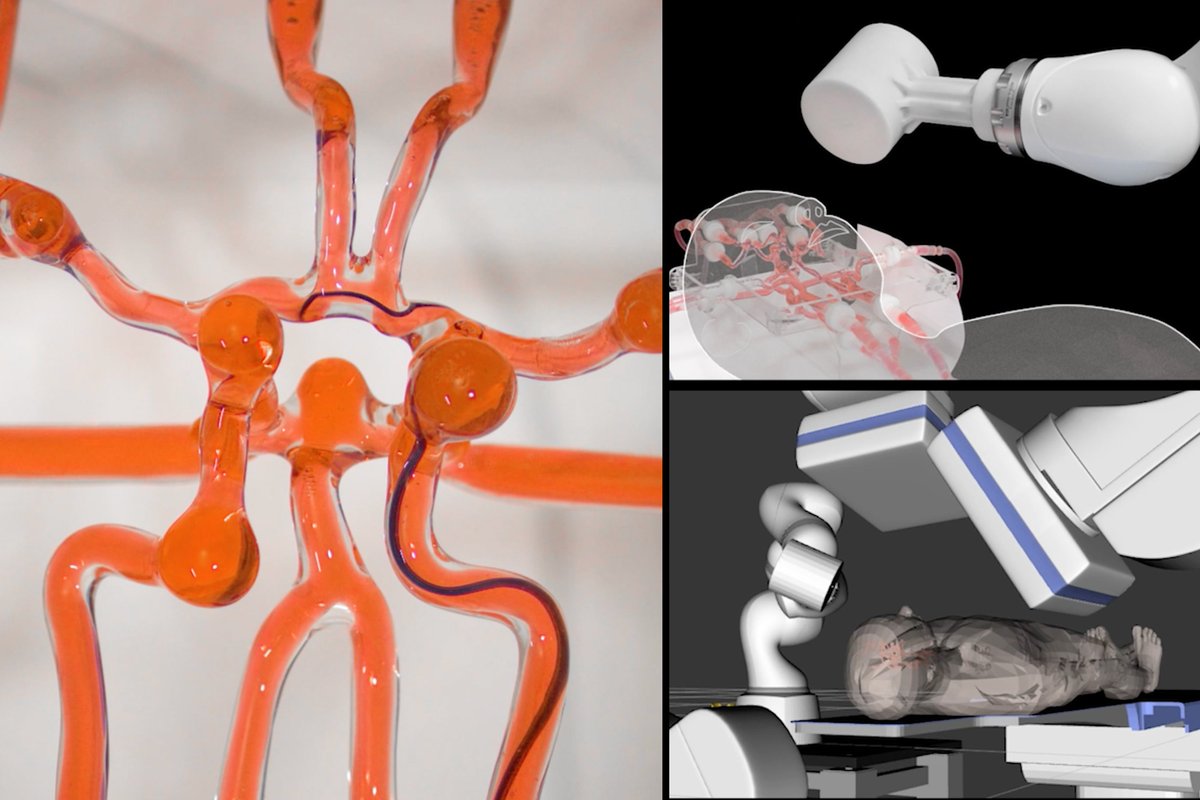 Joystick-operated robot could help surgeons treat stroke remotely: The system could provide teleoperated endovascular treatment to patients during the critical time window after a stroke begins. mitsha.re/WqXf50IJPru