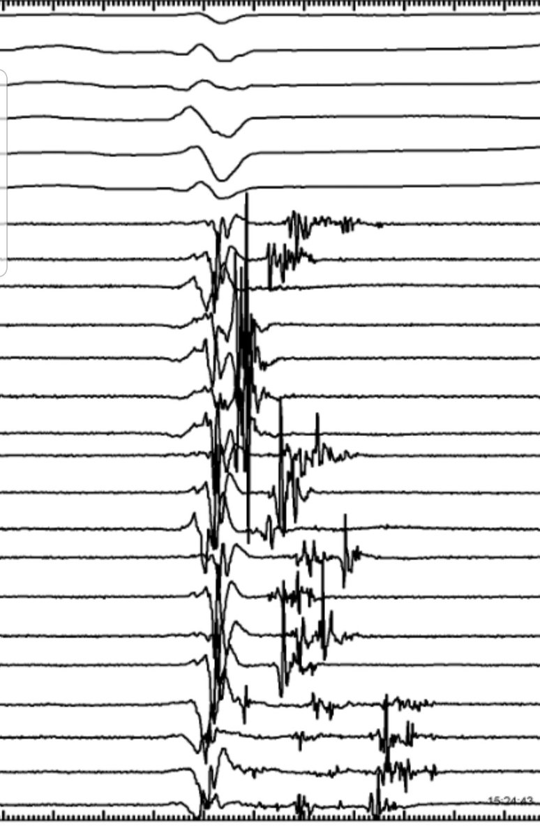Speechless 😶
What a beauty 🥰
#EPeeps #octaray8️⃣ #LatePotentials