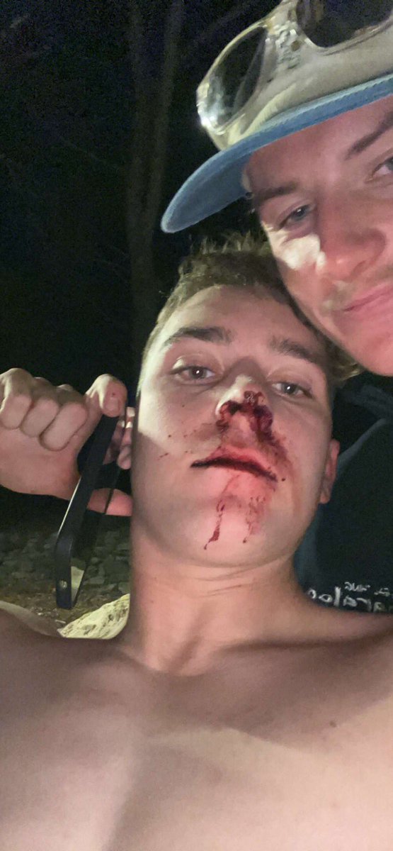 GetOnTheGlizz's tweet photo. Just got knocked out tonight #bringonday2 https://t.co/d0VkU2yTiZ