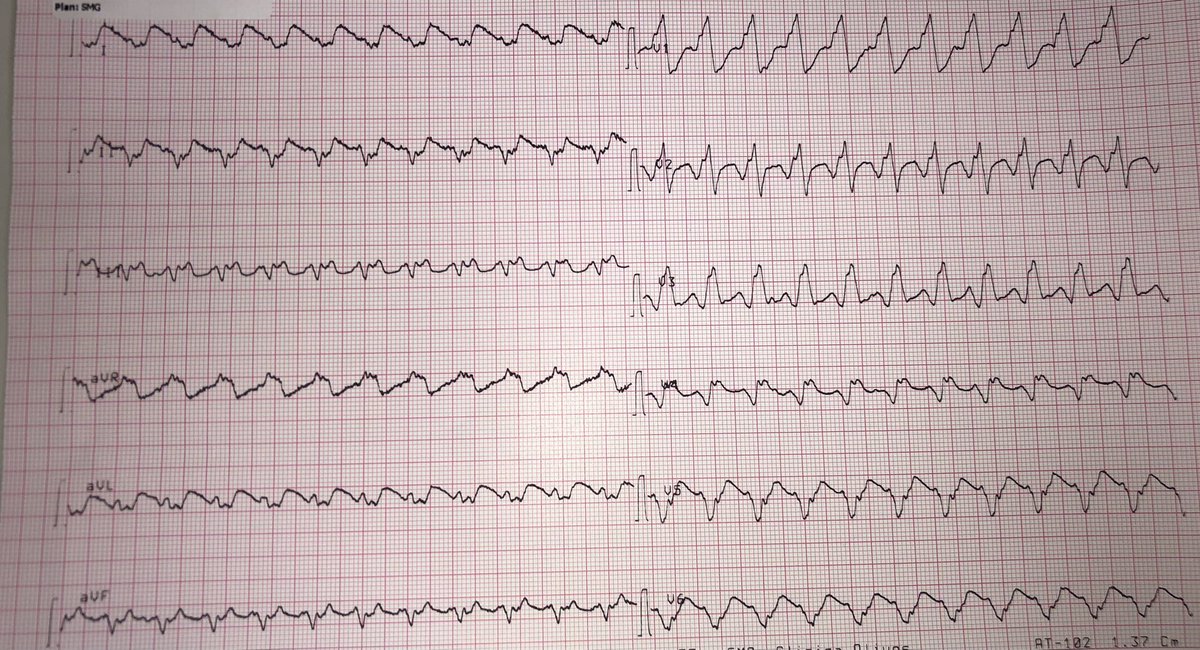 Gonzalo Perez tweet media