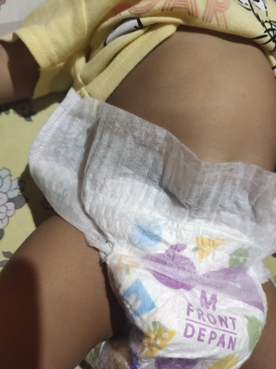 Szputri's tweet photo. @MerriesSmile produk pempes nya  banyak yg begini. Kok bisa lulus sensor ya?
Tolong kualitas nya diperbaiki kembali.
Bismillah yok, diganti pempes size M 1dus besar.
Mayan buat 3bln ank bayi stoknya🥰 https://t.co/rggUgh7lE4