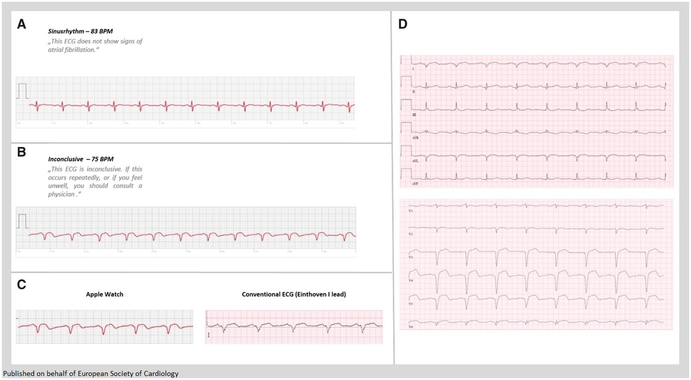 European Society of Cardiology Journals on X