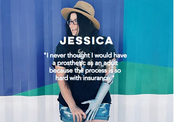 utgiorg's tweet photo. UTGI is here if you are a loved one need assistance with obtaining a prosthetic arm. Visit https://t.co/auTpwpZDOY to learn more. https://t.co/3CTBRX25Z3