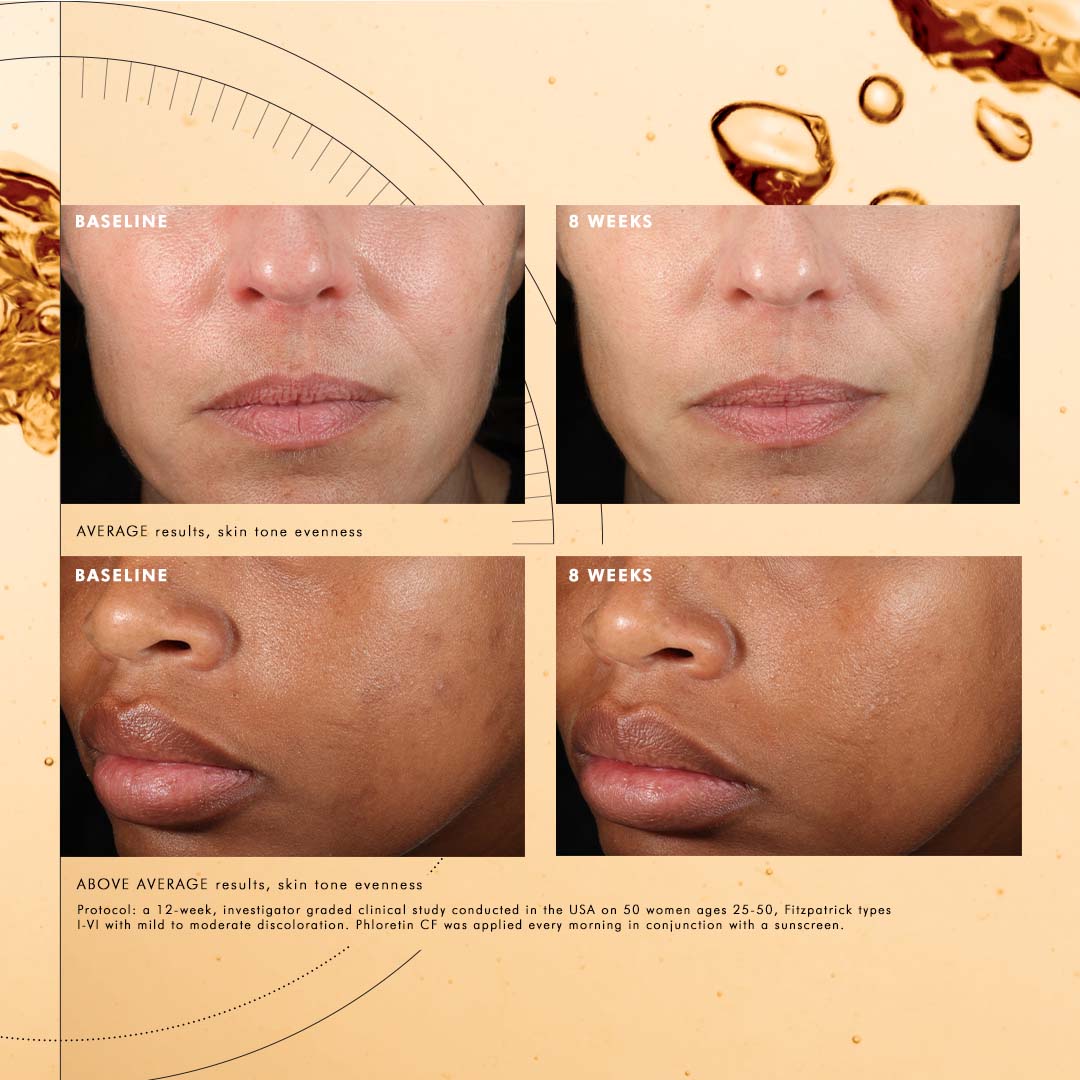 SkinCeuticals's tweet photo. The proof is in the science! Swipe to see the clinical results of Phloretin CF. New proof on all skin tones shows that Phloretin CF evens tone by 20%

#SkinCeuticals #vitaminC #antioxidants #TheAOXAnswer #PhloretinCF https://t.co/R6mj6pzy2c