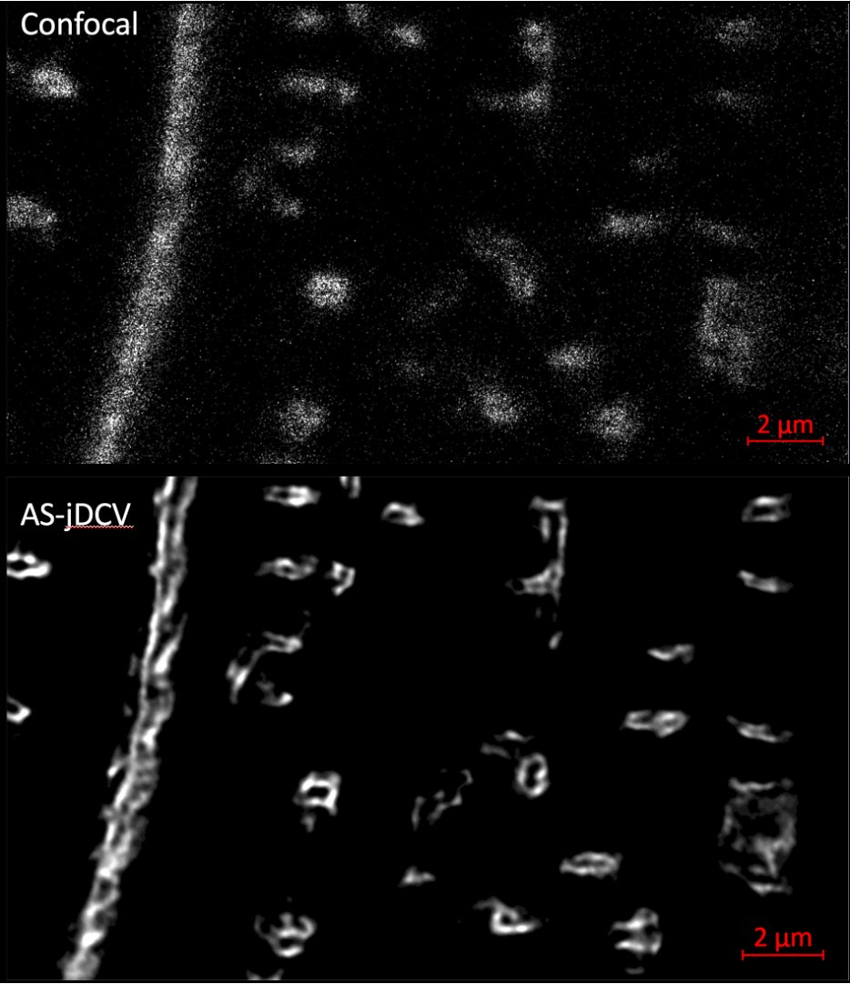 Ben Prosser (@prosser_lab) on Twitter photo <a href="/mikeibrahimmd/">Michael Ibrahim MD PhD</a> <a href="/zeiss_micro/">ZEISS Microscopy</a> Oh and here's the transform, where they become actual tubules :) <a href="/mikeibrahimmd/">Michael Ibrahim MD PhD</a> <a href="/zeiss_micro/">ZEISS Microscopy</a> Oh and here's the transform, where they become actual tubules :)