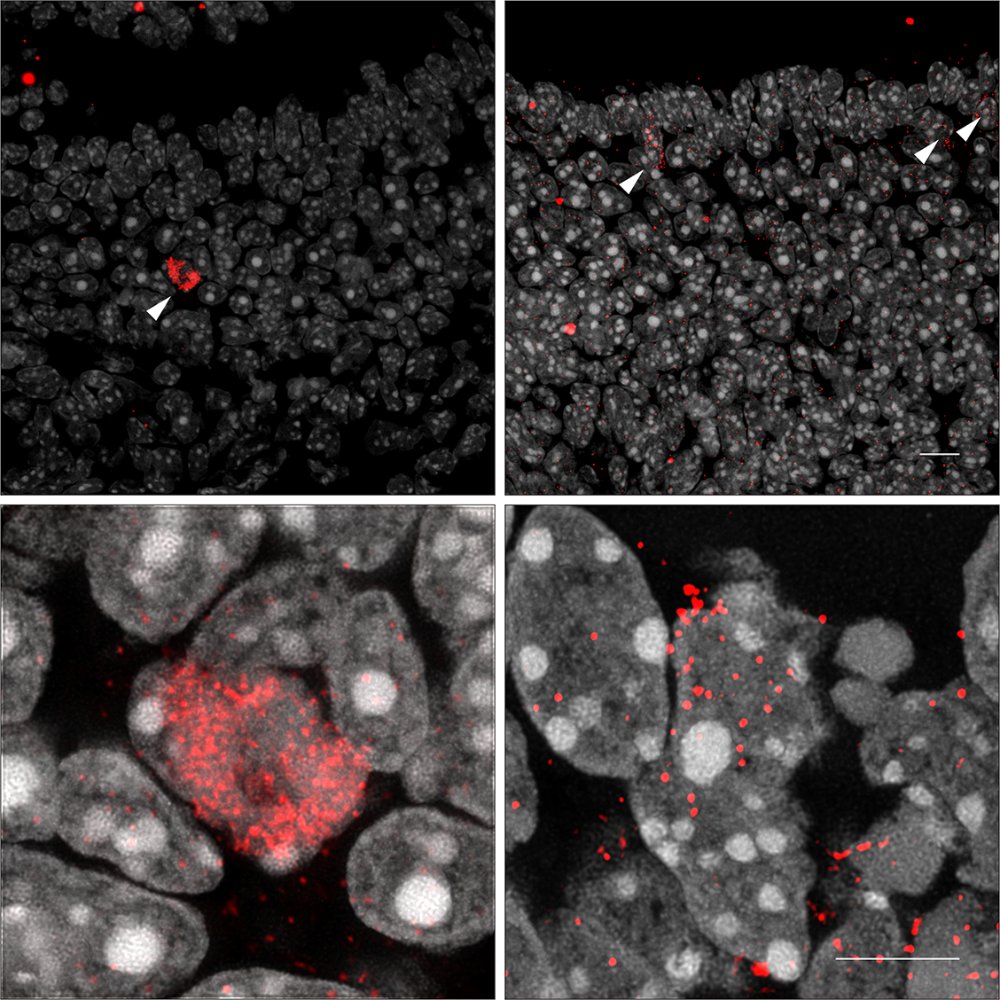ScienceStowers's tweet photo. In a new @CellRepMethods publication, the Yu Lab describes a cost-effective, highly sensitive, & quantitative method for in situ detection of RNA molecules in tissue sections. #RNAdetection #ResearchMethods
https://t.co/Fgj6Yo73KZ https://t.co/F7E127Pve6