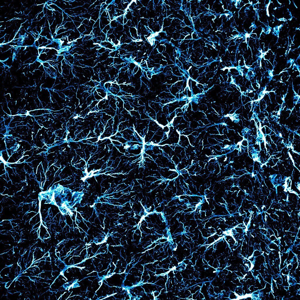 benrogers922's tweet photo. some good Friday hippocampal GFAP 🌟 https://t.co/c47jNJO2rn