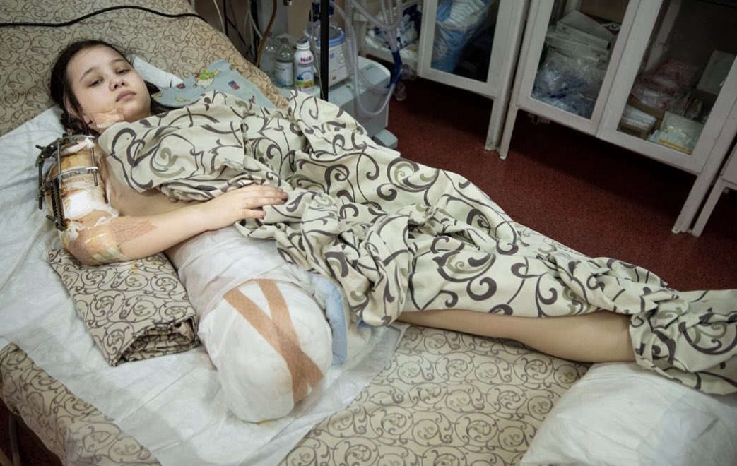 Do you remember Masha? 

Masha is 15.

She had been walking with her mother in their home town of Polohy when a shell landed 10 feet away.

Her right leg had been amputated above the knee.

The good news: Masha is getting better. She is in Germany now.
