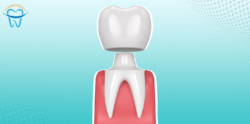 sunnyvaledental's tweet image. Protect a damaged tooth with our effective dental caps. 👨‍⚕️👩‍⚕️🦷 #DentalCaps #TeethCaps #Caps #DentalTreatment #DentalHealth
