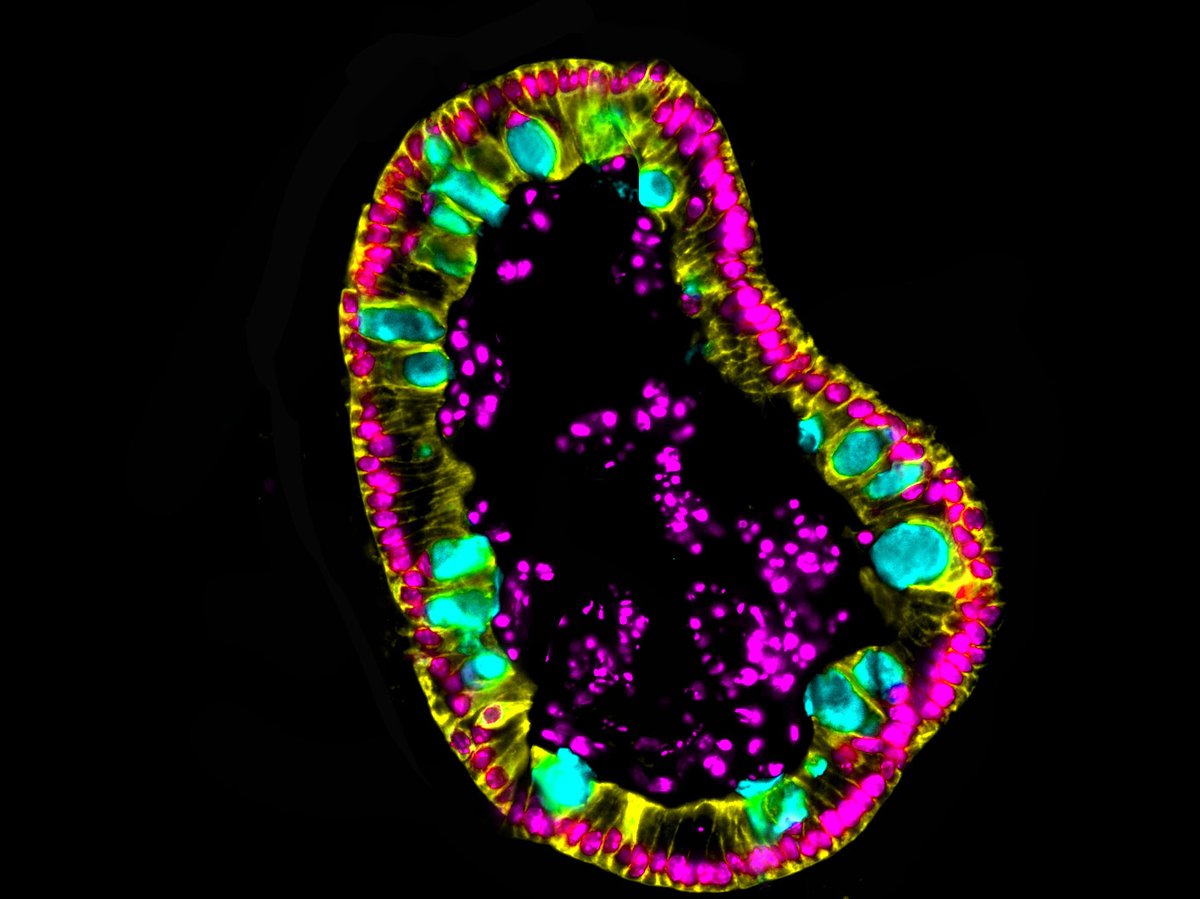 micromindy's tweet photo. It's #organoid time for this #FluorescenceFriday 😄 #bioart #sciart #organoids #enteroids #enteroid #gobletcells #intestine https://t.co/Y7tVfIIJSU
