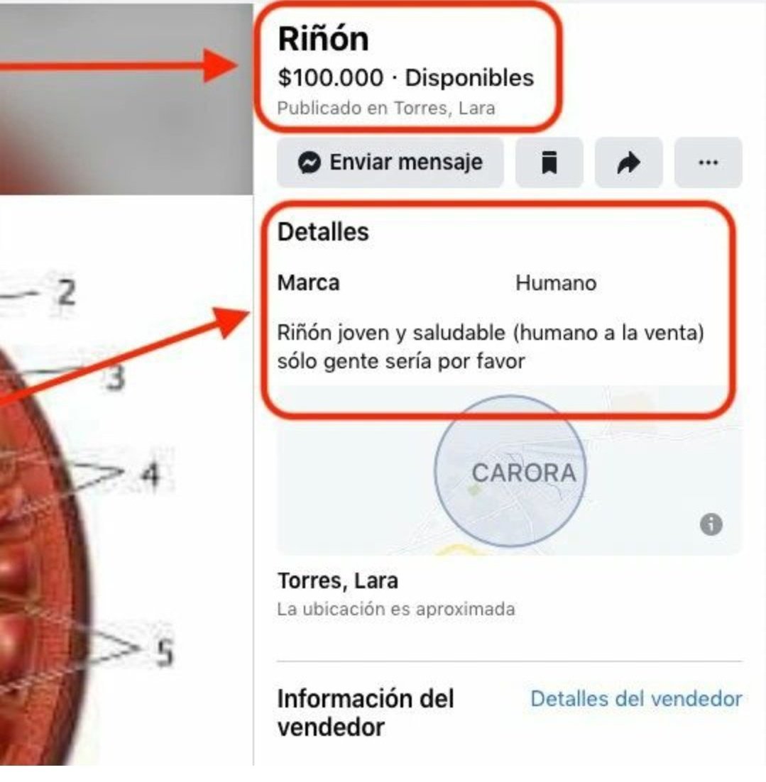 RevoHCF's tweet photo. Interesante!

El nuevo negocio de algunos venezolanos...

A meterle el ojo... en otras partes del mundo es en la #DeepWeb en Venezuela es en Market Place https://t.co/NwFKeZ0dHr