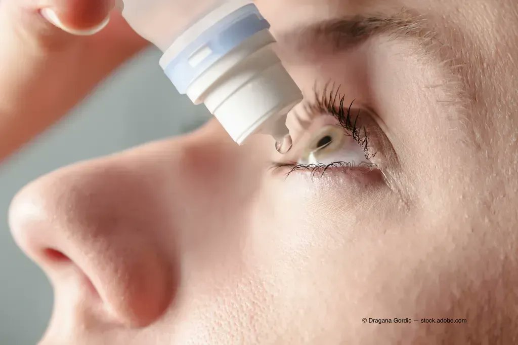 OphthTimes's tweet photo. How novel autoantibodies may improve screening #DryEye patients for Sjogren's syndrome:
More: https://t.co/sIcocPH6lt
#ophthalmology #Sjogrens #PatientCare #Ocular #Cornea #Clincal https://t.co/DeAetBpjAO