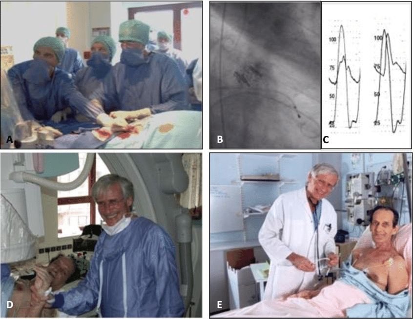 Eduardo Infante de Oliveira (@eideoliveiramd) on Twitter photo Celebrating today the 20th anniversary of TAVI / TAVR! Thanks to A. Cribier and all the pioneers that made it possible! <a href="/AlainCribier/">Alain Cribier</a> @MartyMleon <a href="/EAPCIPresident/">EAPCIPresident</a> <a href="/PCRonline/">PCRonline 🫀</a> <a href="/escardio/">European Society of Cardiology</a> <a href="/APIC_pt/">APIC</a> <a href="/spcardio/">Sociedade Portuguesa de Cardiologia</a> Celebrating today the 20th anniversary of TAVI / TAVR! Thanks to A. Cribier and all the pioneers that made it possible! <a href="/AlainCribier/">Alain Cribier</a> @MartyMleon <a href="/EAPCIPresident/">EAPCIPresident</a> <a href="/PCRonline/">PCRonline 🫀</a> <a href="/escardio/">European Society of Cardiology</a> <a href="/APIC_pt/">APIC</a> <a href="/spcardio/">Sociedade Portuguesa de Cardiologia</a>
