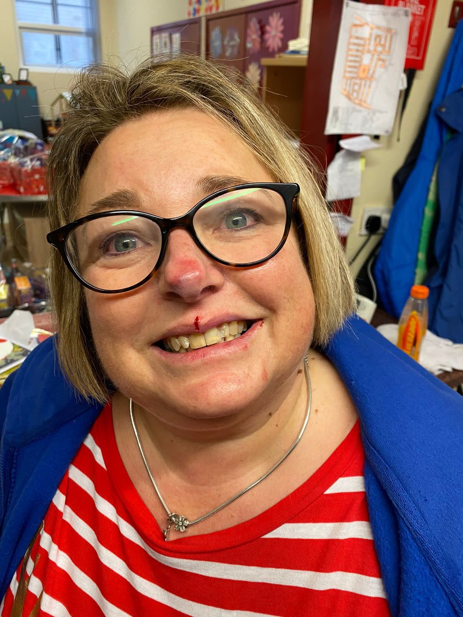 BloomfieldCommA's tweet photo. The Best People who will risk Lip & Nose for Our Wee Community 🦋 ps Elaine’s injuries happened at Christmas having a ‘Wee Go’ on the Bouncy Castle - she recovered well thank Goodness 💜 She was barred this time round lol xx
#BCATeam https://t.co/GIfKecOy4N