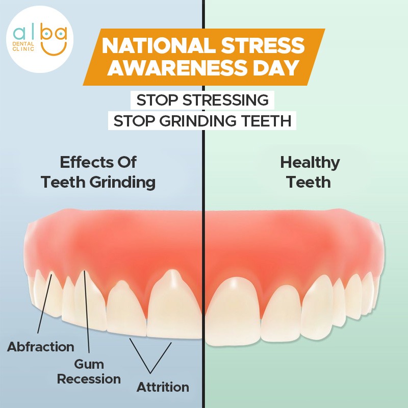 albadental_in's tweet photo. Increased anxiety or stress can lead to teeth grinding. So can anger and frustration ✅
Which leads to Bruxism 😬
Stop Stressing and Stop Grinding 💯
#stressawarenessday
.
.
.
#stress #stressday #anxiety #dentalproblem #nationalstressawarenessday #teethgrinding #teethissues https://t.co/C0W4H3GVrz