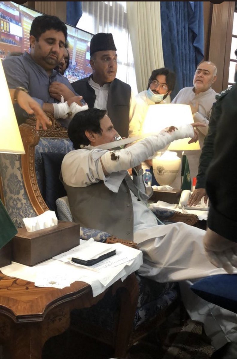 SImranshafqat's tweet photo. یہ ٹوٹا بازو اوپر کی��ے اٹھایا جاسکتا ہے ؟ اگر کوئی آرتھوپیڈک سرجن سمجھا سکے تو مہربانی ہوگی https://t.co/mORqww6VmH