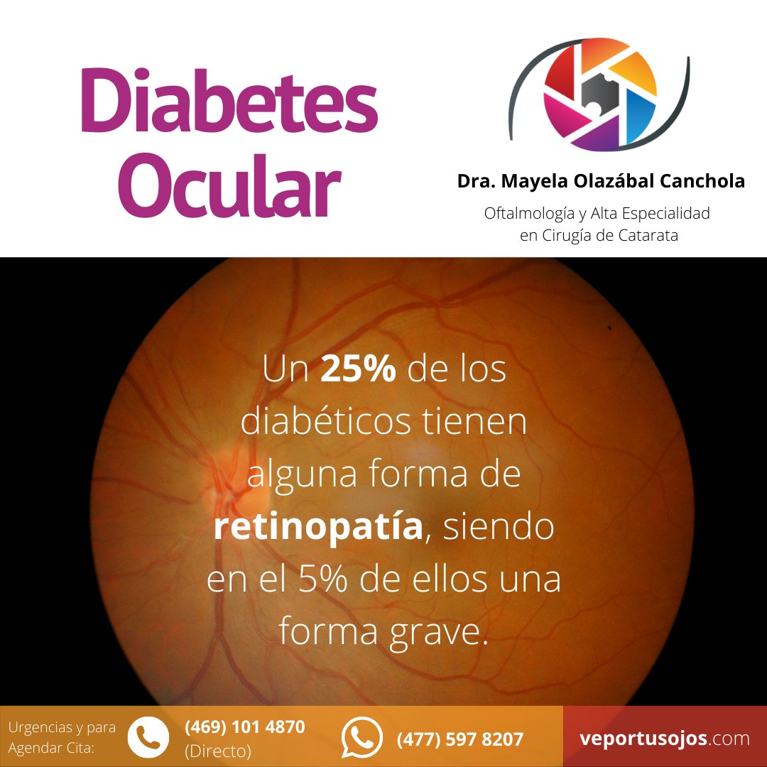 📞 Urgencias y Citas: (469) 101 4870 (Directo) (477) 597 8207 (Whatsapp) 📅 veportusojos.com #OftalmologaMayela #OftalmologoGuanajuato #VeportusOjos #OptometristaGuanajuato #CirugiaCatarata #CirugiaOftalmologica #SoyOftalmologoCertificado