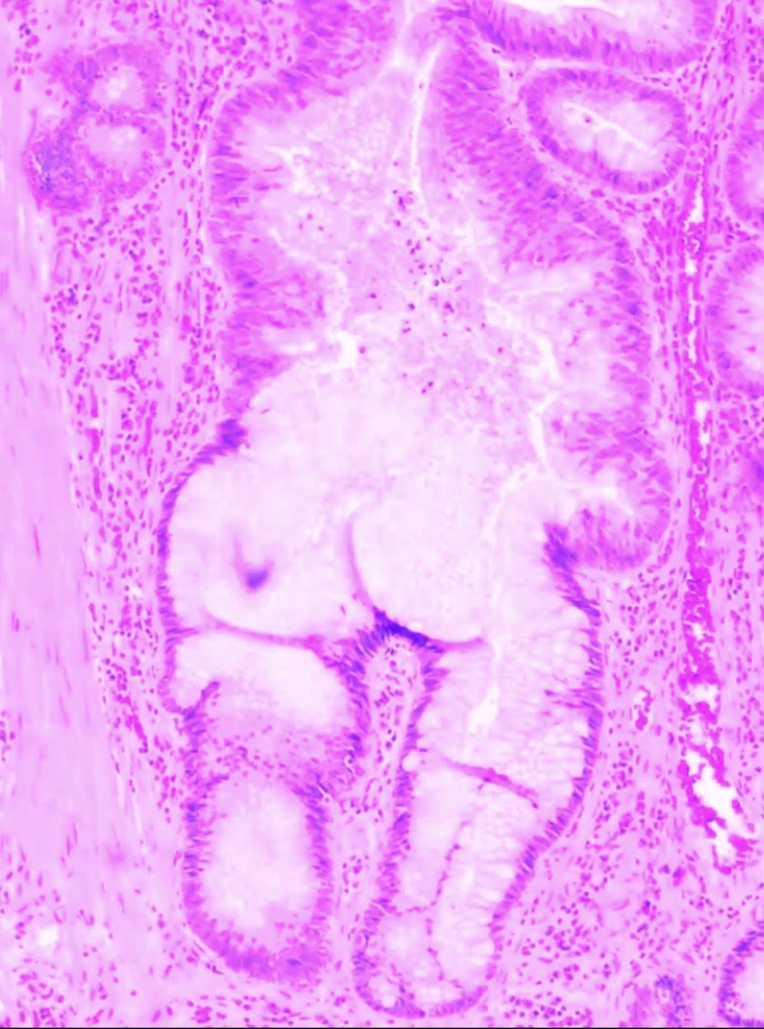 DaoudRahal's tweet photo. @DrMoeAtieh @loyolapathology @Vijuananthan @KMirza @barkanga Botero’s butts #PathTwitter https://t.co/JUdR512OH4