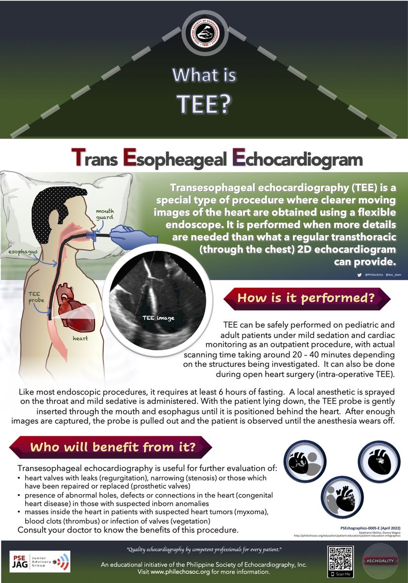 doc_jdam's tweet photo. ANO ANG TEE?
What is a Transesophageal Echocardiogram?
Ano ang pinagkaiba nito sa pangkaraniwang 2D echocardiogram? Ito ba ay ligtas at makakatulong upang malaman ang kundisyon ng aking puso?
Visit https://t.co/24V7drRaYY to download the graphics.
#PSEchographics #ECHOALITY https://t.co/b46BmAGWJc